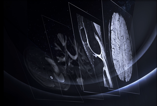 Breaking the Limits! The World's First 5.0T MR Images of Human Body Revealed 