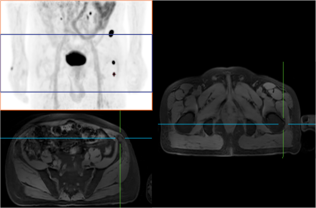 Stages of Life under Super Wide Angle