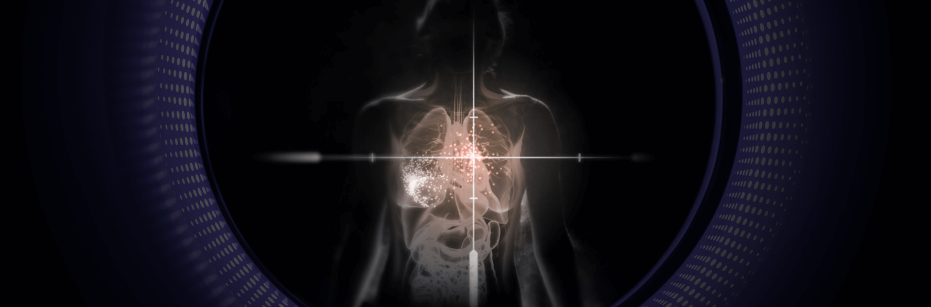 UC Davis' new research shows how total-body PET imaging can assess the immunological response to COVID-19 infections