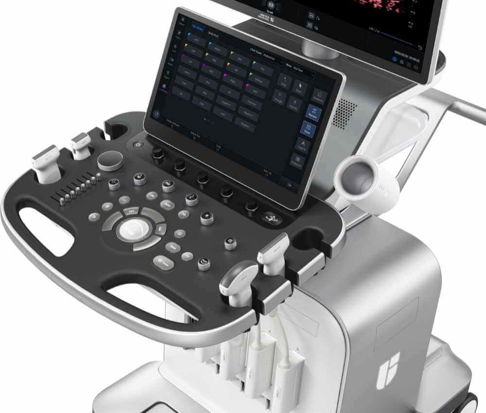 uSONIQUE Genesis ultrasound system