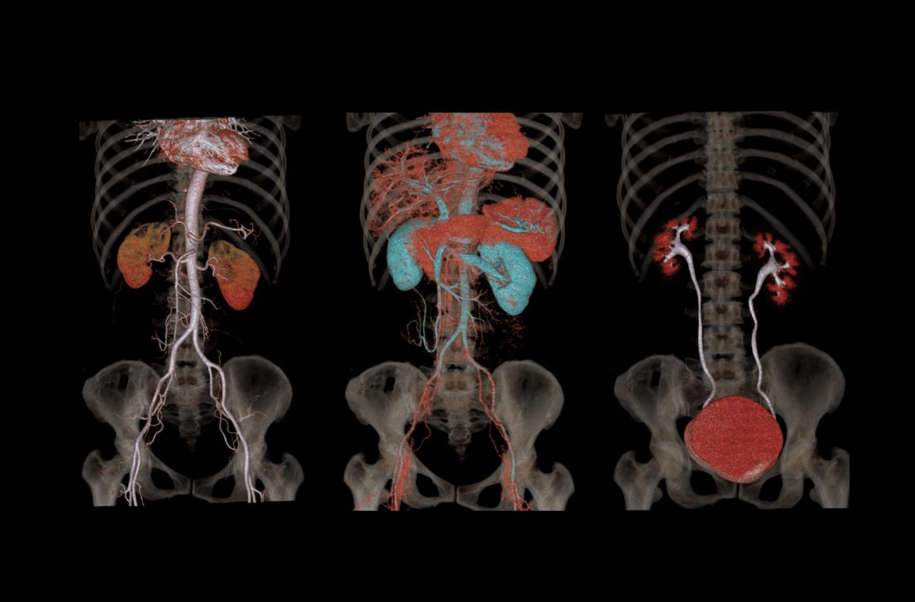 Consecutive CTA+CTV+CTU