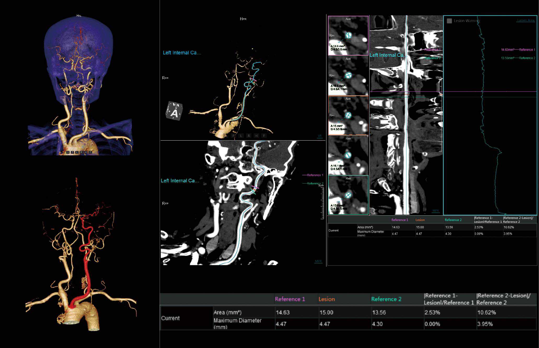 Applications - Vessel Analysis