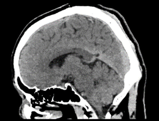 Half-Second Full Brain<sup>*</sup>