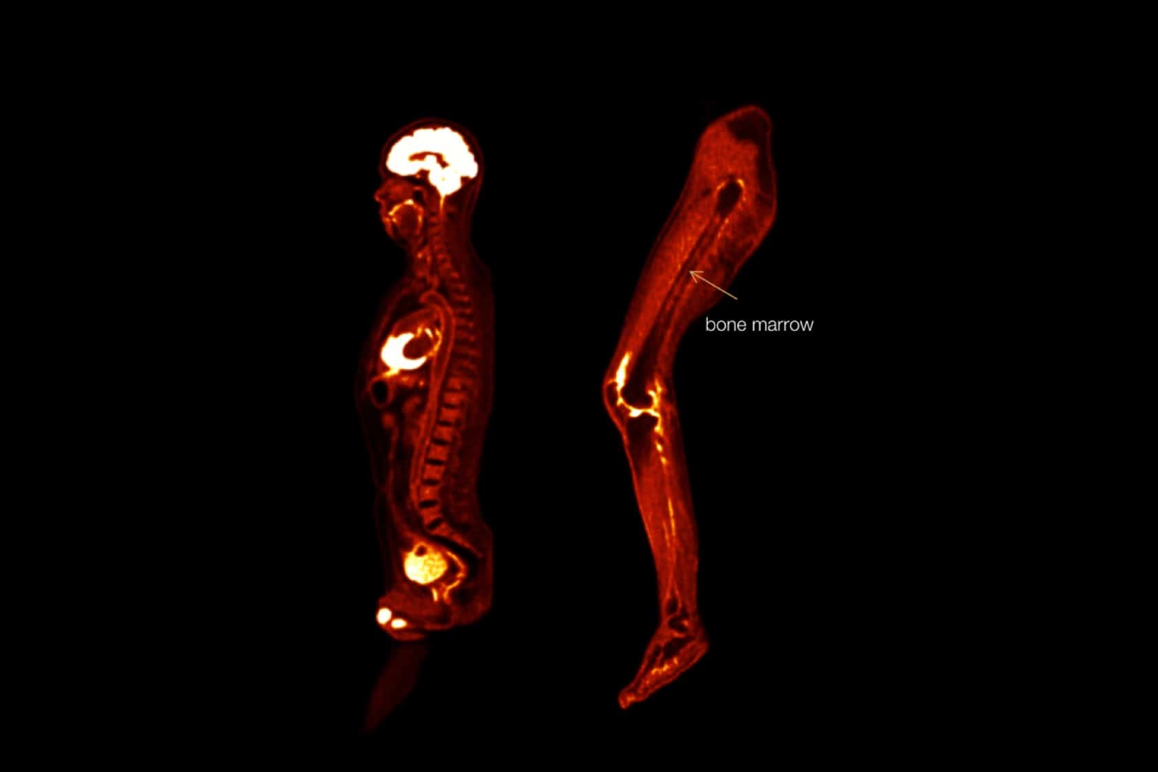 View detailed sagittal and coronal slices with thin axial slices. 