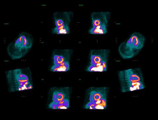 Cardiac Imaging