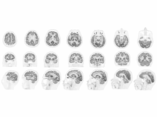 High Resolution Neuro Imaging