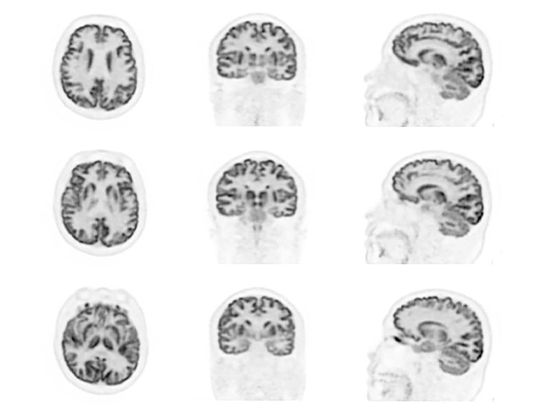 High‐Resolution PET