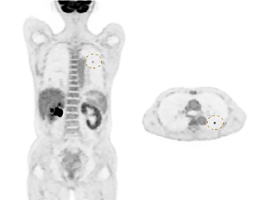 Quantitative Accuracy for PET