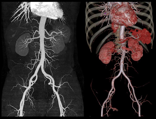 Fine Vascular Structure
