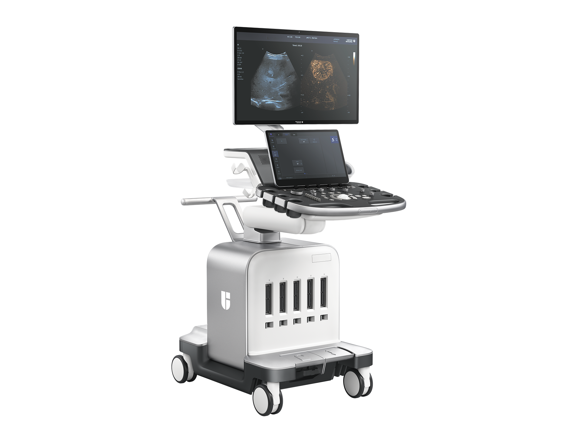uSONIQUE® Genesis ultrasound system with monitor and general imaging control panel.