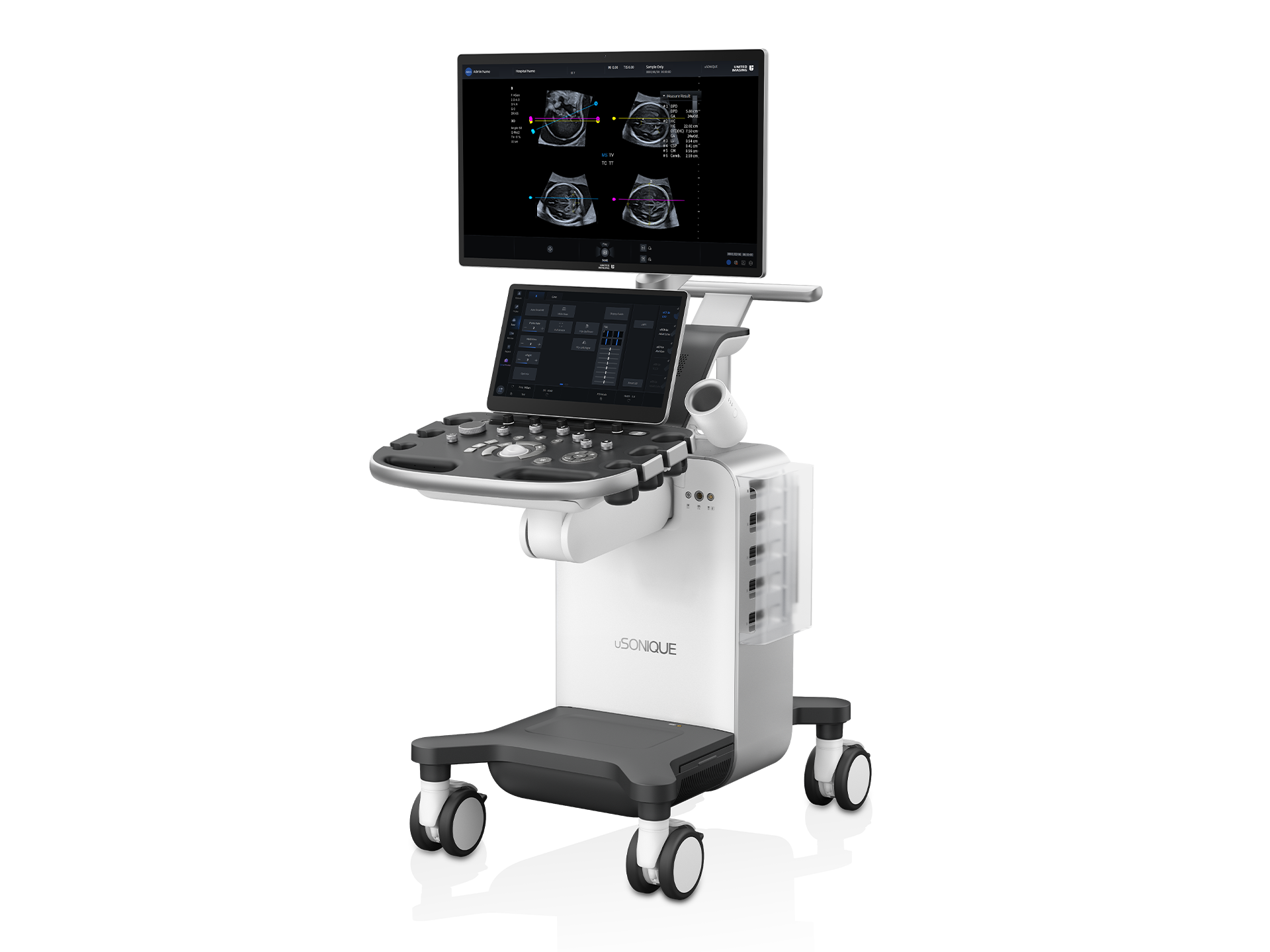 uSONIQUE® Grace ultrasound system with monitor and women’s imaging control panel 