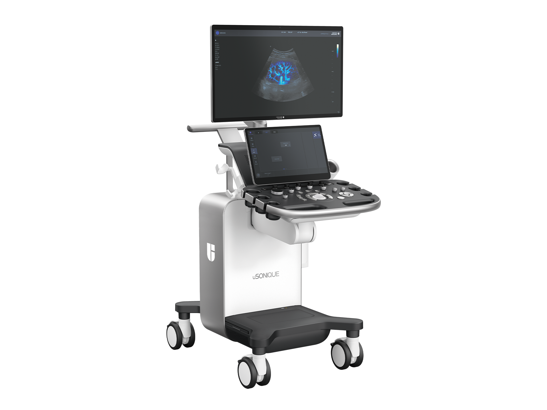 uSONIQUE® Nova ultrasound system with monitor and general radiology control panel.