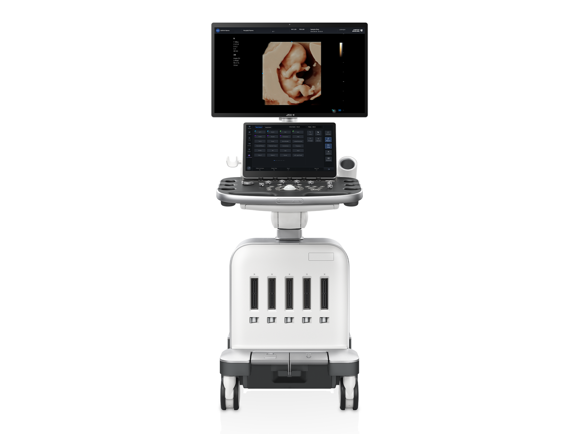 uSONIQUE® Venus ultrasound system with monitor and women’s imaging control panel